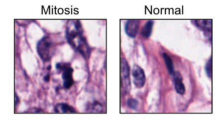 Mitosis vs. normal cell. Used with Anika Cheerlas permission 