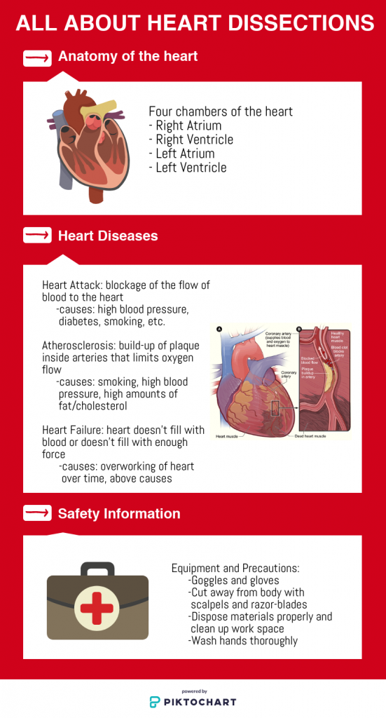 SNHS prepares for heart dissection meeting – El Estoque